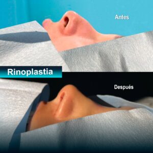 Cirugía en mujer menor de edad hace 7 años